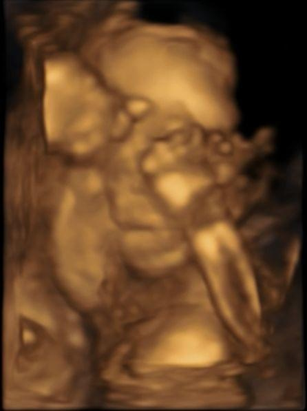 b3742386afa88891med.jpg