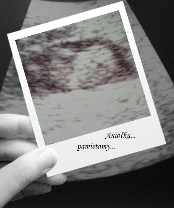 Aniołek [*]